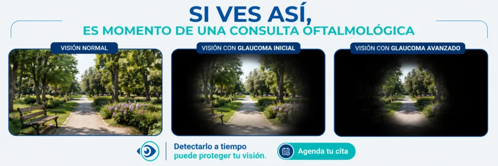 como se ve con glaucoma