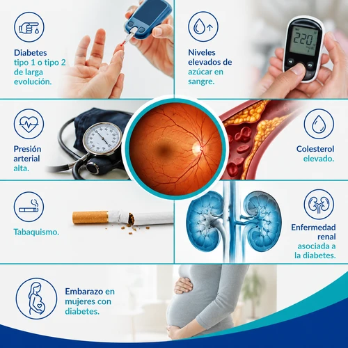 causas de retinopatia diabetica