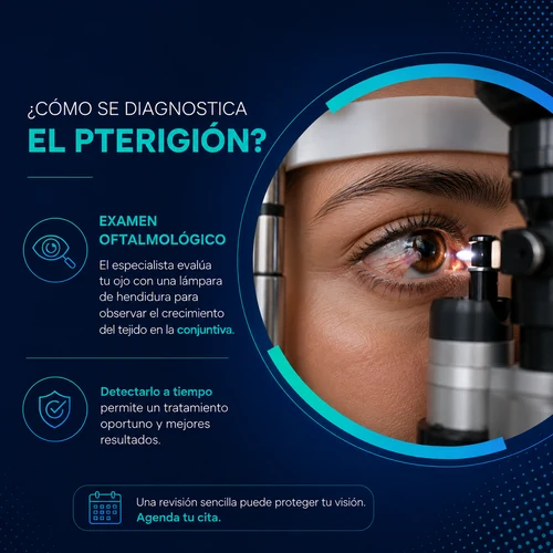 diagnostico pterigion