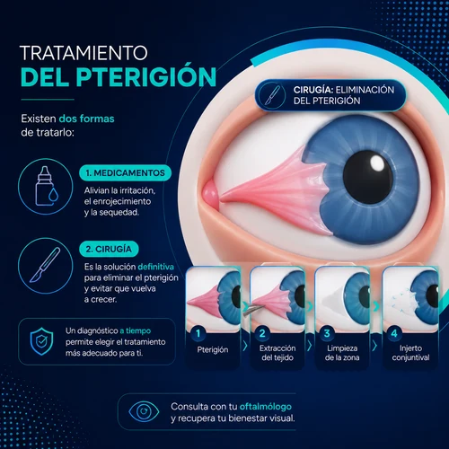 tratamiento pterigion