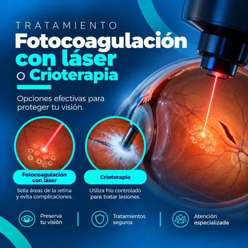 tratamiento desgarro de retina